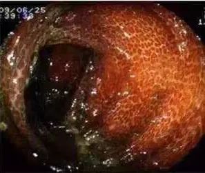 揭秘网红减肥产品,网红卖的减肥产品真的有效果吗