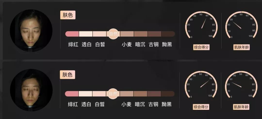 灏忚寕鑲岃瘖瀹ゅ埌搴曟湁澶氬己,灏忚寕鑲岃瘖瀹よˉ姘村悧