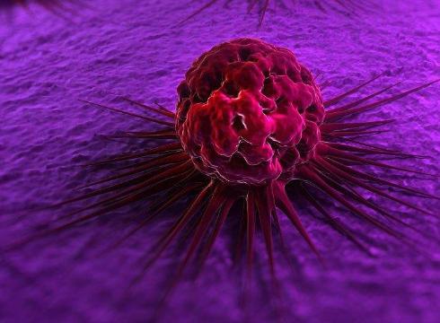 哪些痣会癌变的,哪些痣会癌变