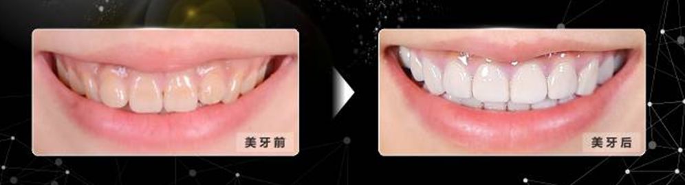 速看！11月起，这些新规实施，矫正牙齿、种植牙这些费用全免！