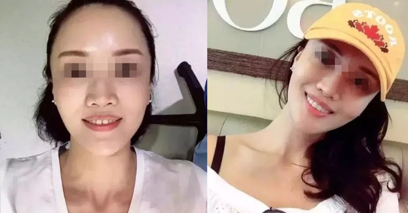 速看！11月起，这些新规实施，矫正牙齿、种植牙这些费用全免！