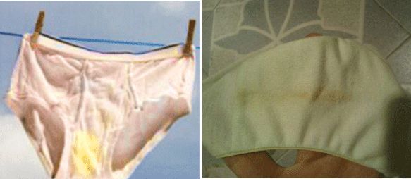 瘙痒难忍、有异味、反复发作，是你这里出了问题！