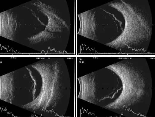 一个眼科医生的亲身经历,采访眼科医生后的感悟