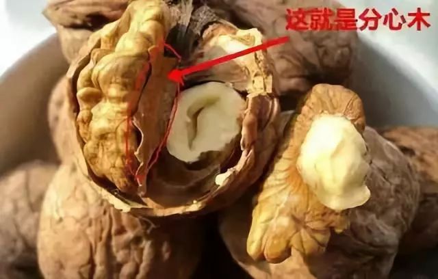 腰酸背痛精力不足是什么原因,腰酸背痛肾气不足