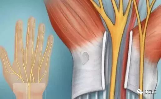 鼠标手康复科普文章,鼠标手的康复和治疗