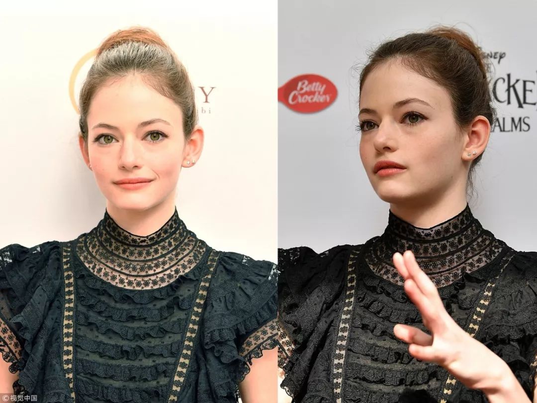 去掉眼袋之后天壤之别,无美颜无滤镜遮泪沟眼袋