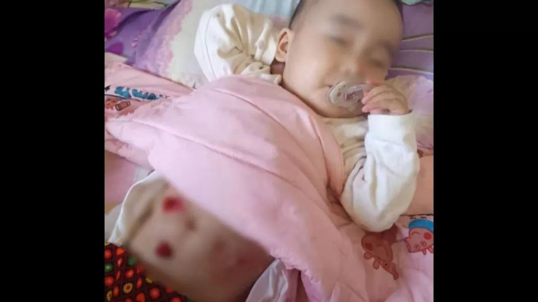 一岁女孩患18种罕见病,女童身患多种罕见病医生不敢治