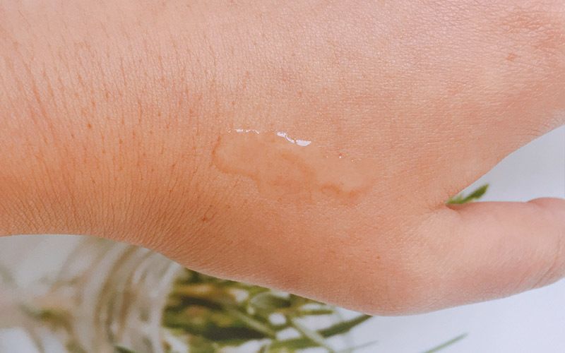 口腔溃疡反复发作吃什么容易愈合,口腔溃疡一抹止痛