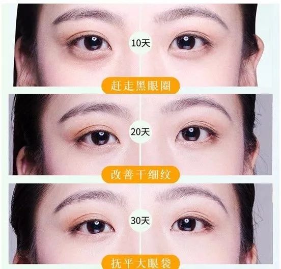 韩国品牌眼霜补水保湿,推荐一款韩国好用的眼霜