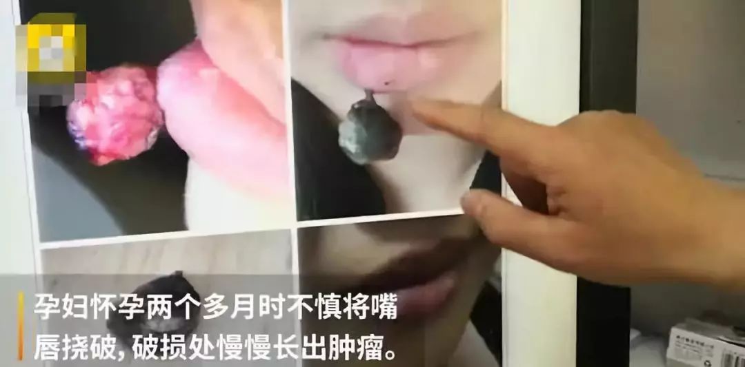 干裂救星护手霜,唇干裂用什么润唇好