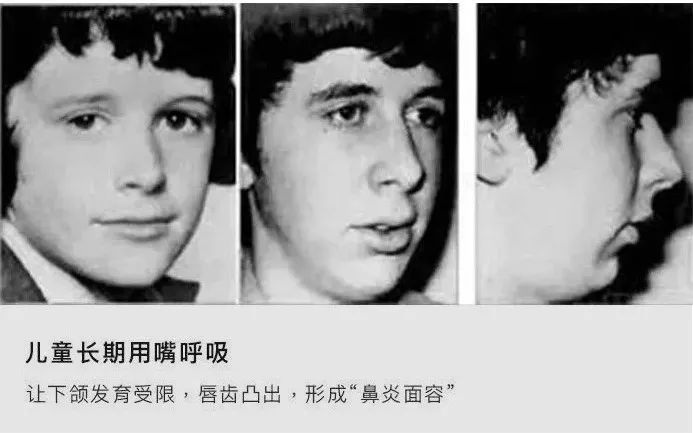 鼻炎克星鼻舒宁鼻通抑菌液,鼻炎克星宣肺通窍