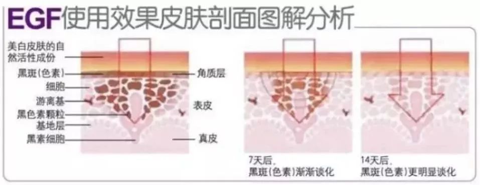 山羊奶面膜好用吗,不到5块一片的面膜