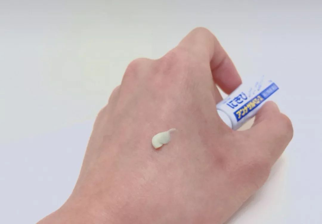 痘痘肌必买药膏有哪些牌子,痘痘肌必看五种痘痘类型