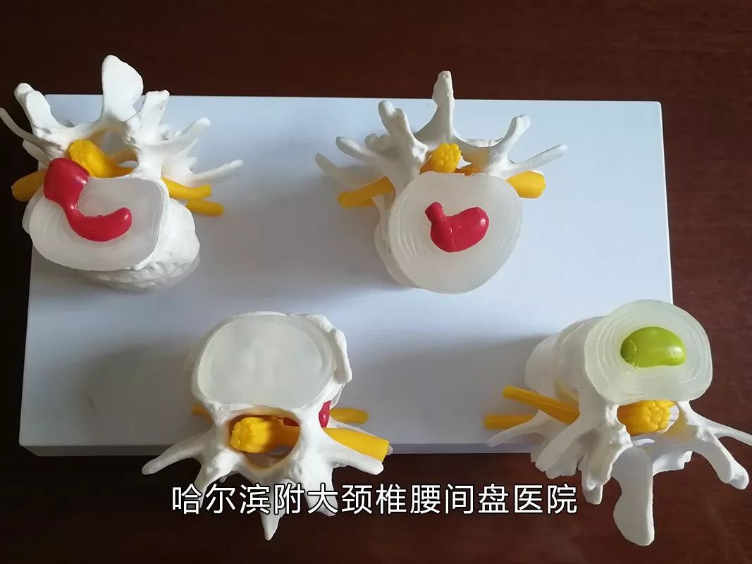 有没有感觉到腰酸腿疼特别棒,你是否觉得腰酸背痛容易累