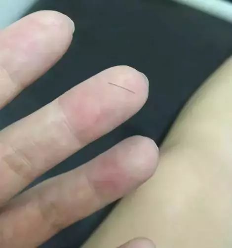 男子理发后被送上断头台,男子理发后昏迷