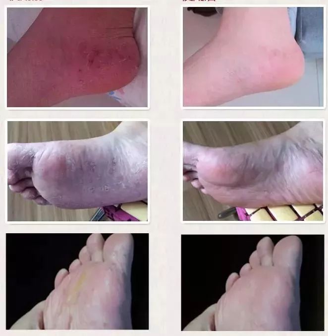 清凉止痒防暑醒神膏,止痒的草药膏