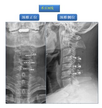 大连开发区筋骨堂正骨推拿,筋骨堂中医正骨推拿简介