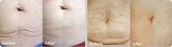 同样是减肥你为什么瘦不下来,同样是减肥为什么你减肥那么慢