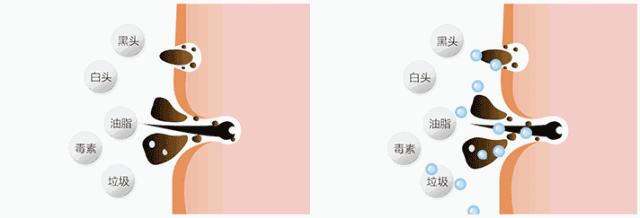 火山泥膜深层清洁面膜测评,嫩肤的白泥面膜评测