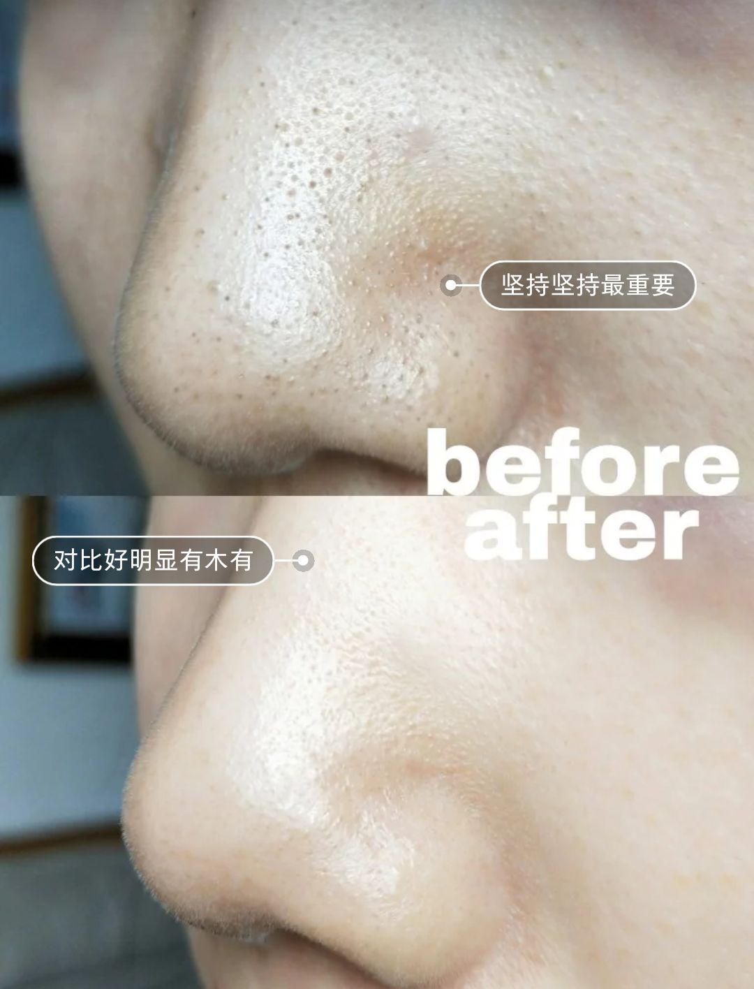 火山泥膜深层清洁面膜测评,嫩肤的白泥面膜评测