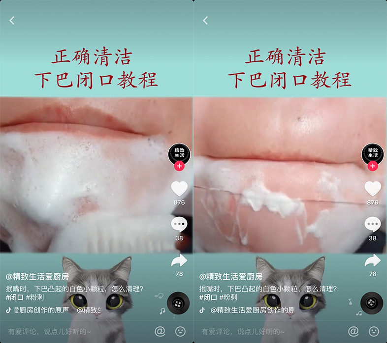 一直在长闭口,为什么总愿意长闭口