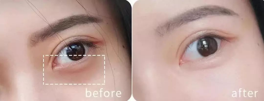 韩国品牌眼霜补水保湿,推荐一款韩国好用的眼霜