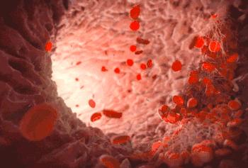 网红带火“净血美容”，5万一次能“防癌”？真相是……