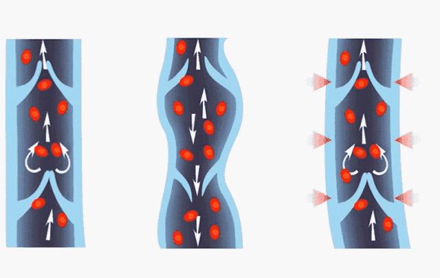 10倍燃烧卡路里！意大利夜光魔力裤，看得见的燃脂，30天还你超模腿！