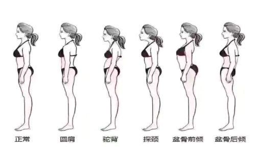 女人骨盆移位怎么造成的,女性骨盆倾斜的纠正手法