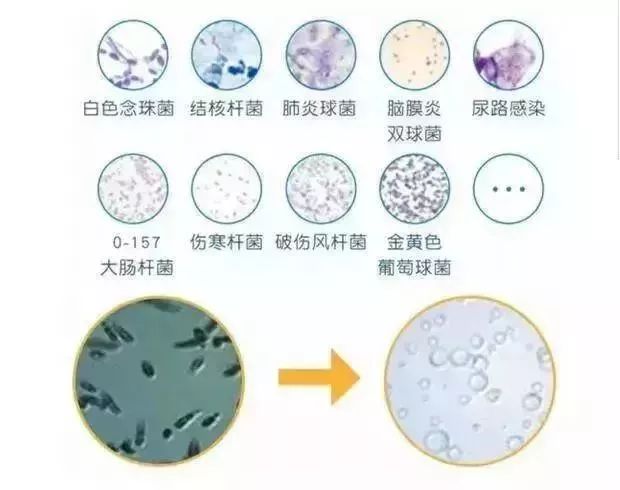 白衣脏洗不掉怎么办,衣领上的皮肤油渍用什么洗效果好