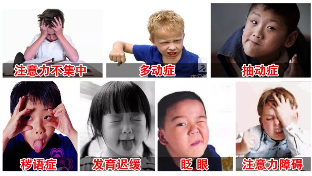 注意力不集中多动影响学习,注意力不集中不听话做什么训练