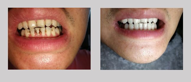 公认去牙黄最好的牙膏老爸评测,去牙渍去口气的牙膏测评