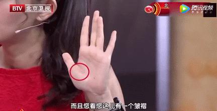 手上突然有青筋是什么原因,突然看到手上有青筋什么原因