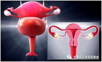 社区三八妇女节关爱女性健康活动,三八妇女节关爱女性健康知识