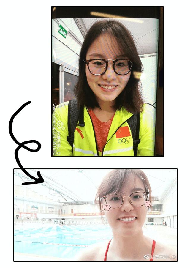 苏州口腔医院补牙,苏州补一颗牙齿需要多久