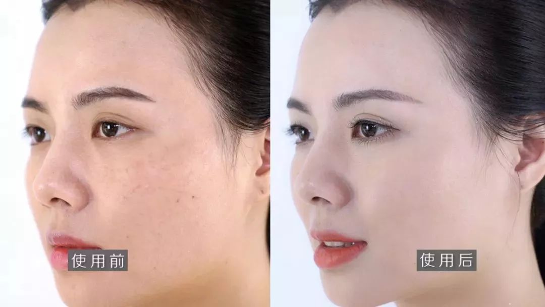 祛斑美白补水祛皱祛痘,祛斑祛痘美白改善暗沉
