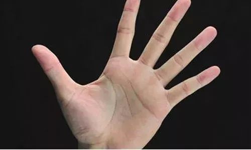 手上突然有青筋是什么原因,突然看到手上有青筋什么原因