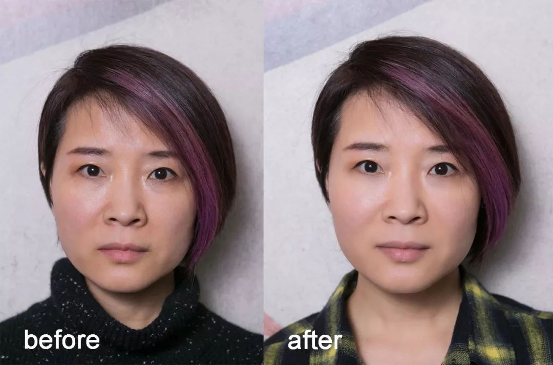 小茂肌诊室到底有多强,小茂肌诊室皮肤状态