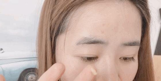 5个祛斑小妙招淡化晒斑雀斑痘印,晒斑痘印怎么消除的最快方法