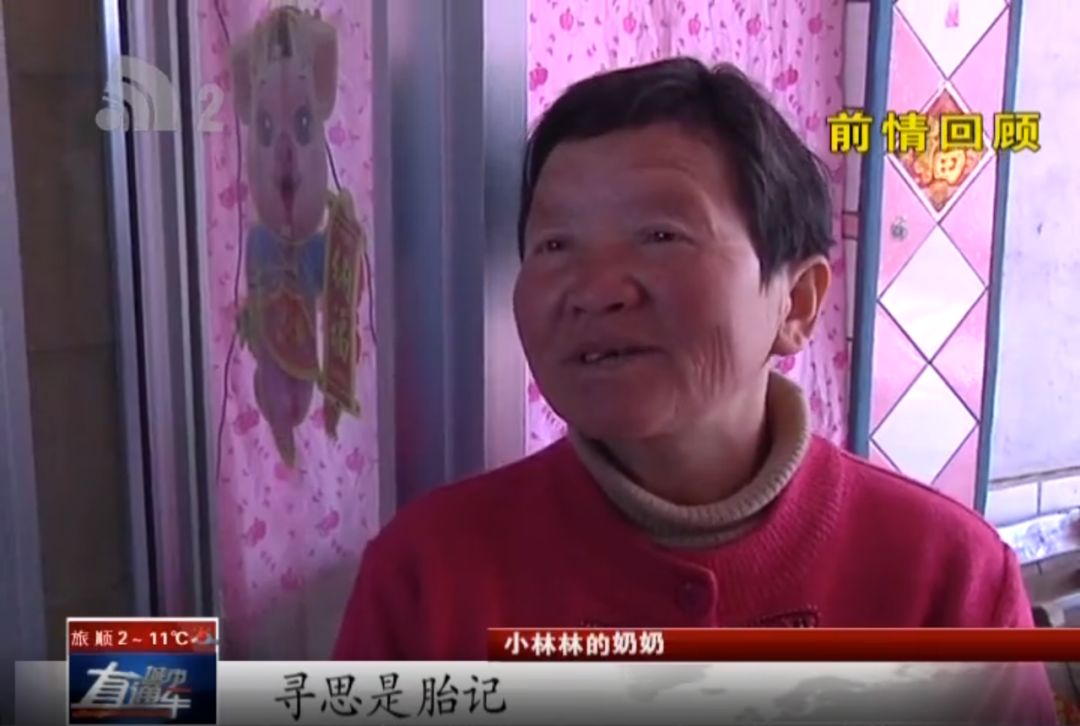 帮忙大小王|留守儿童手肿像水球大王帮忙查明病因