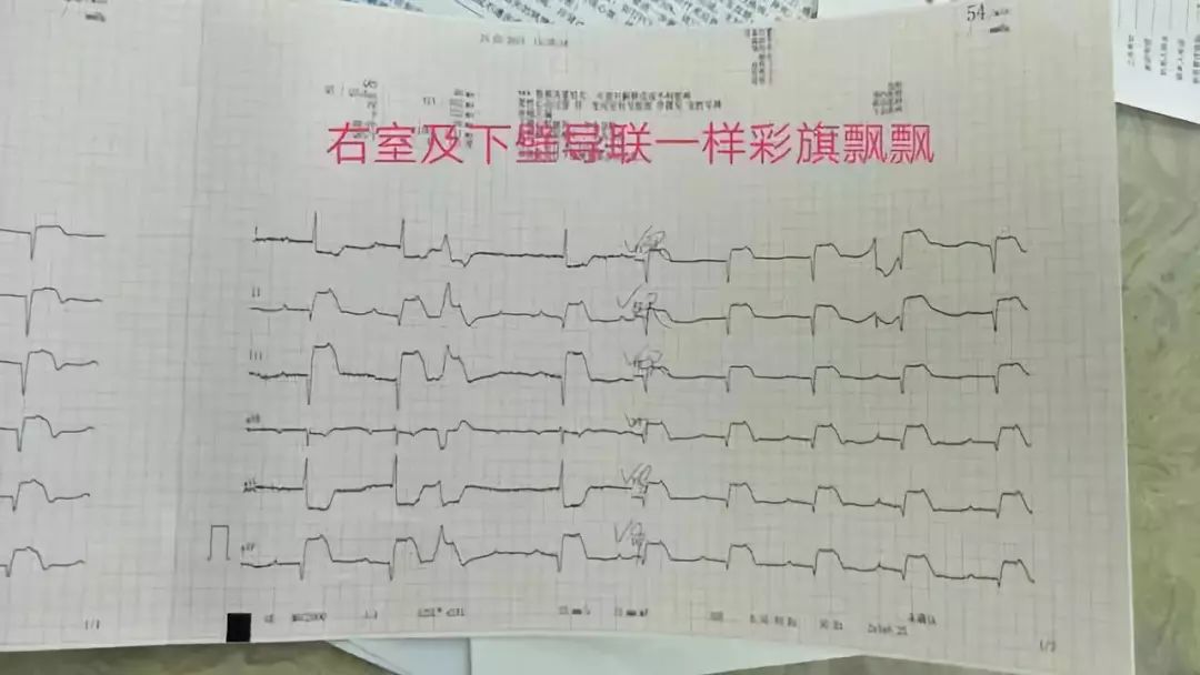 急性心肌梗死院前急救的急救措施,中医治疗急性心肌梗死的急救方法