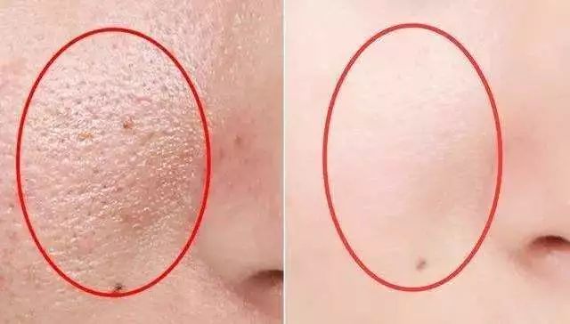 用了几年的火山泥一洗白,用火山泥洗澡