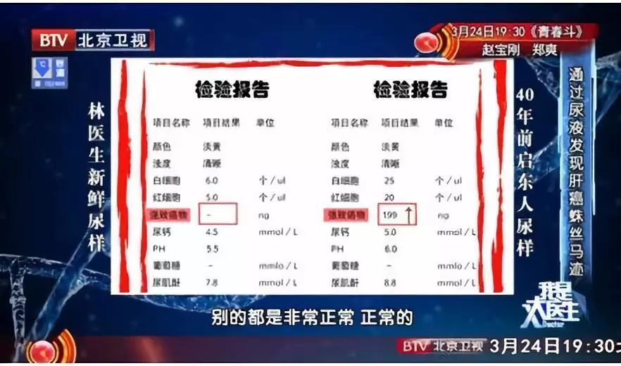 肝毒的克星蔬菜,这种食物是肝脏清道夫