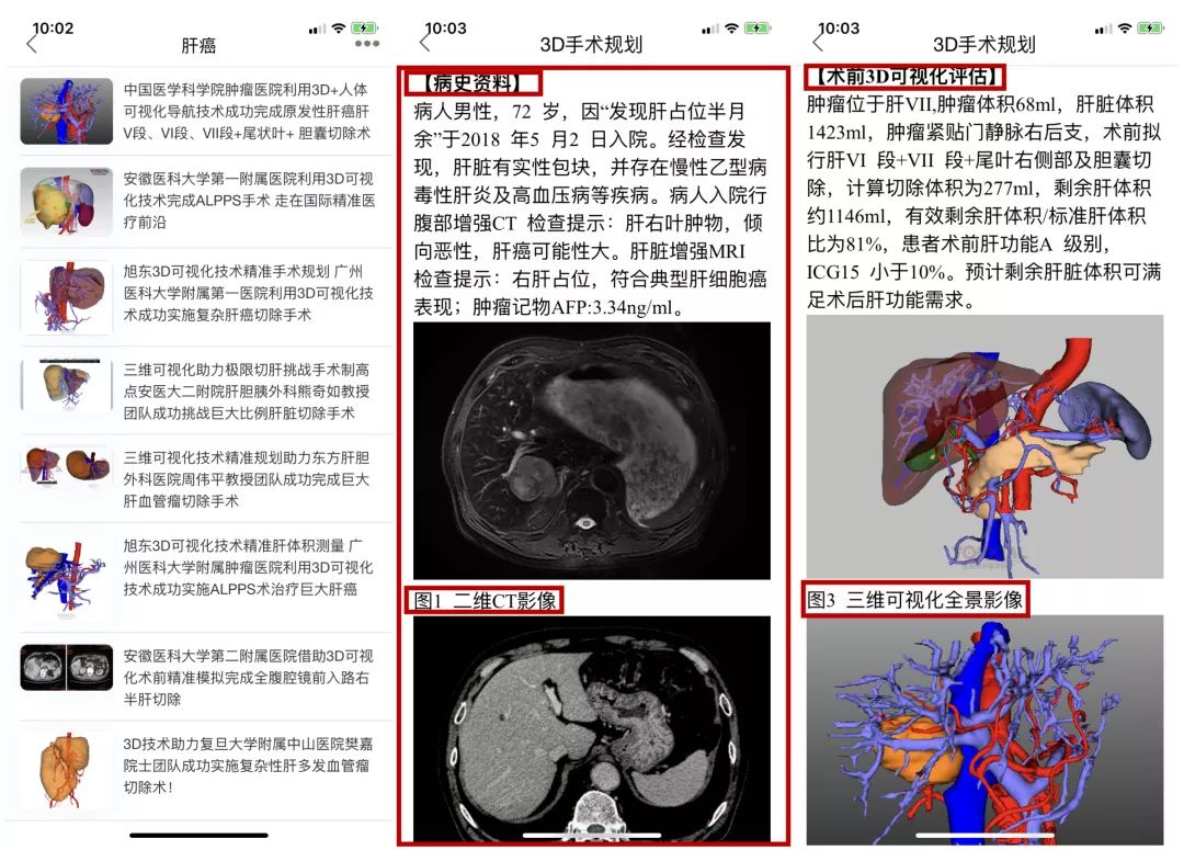 人卫临床助手APP：临床医生学习成长，辅助诊疗的智慧助手，荟萃权威医学知识，融合大数据人工智能技术，全新版本隆重上线，敬请使用