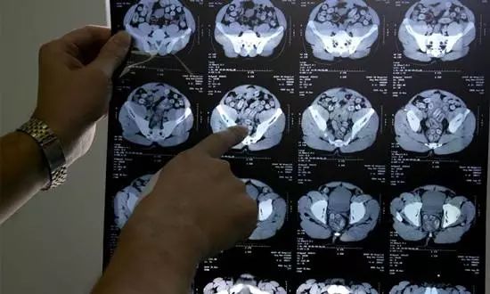 三分钟带你了解吸毒的危险,吸毒太可怕请珍爱生命远离毒品