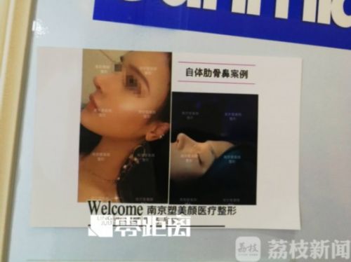 南京整形医院美容科,南京塑美整形医院