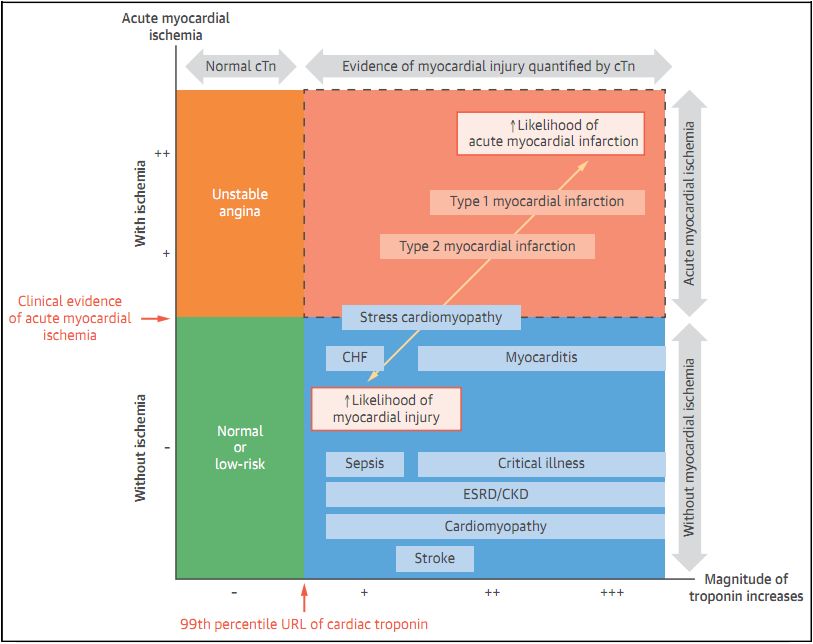 急性st段抬高型心肌梗死指南2019,什么是急性非st段抬高型心肌梗死