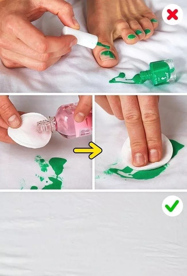 衣服发黄用什么漂白剂比较好,用漂白剂把白色衣服漂黄了怎么办