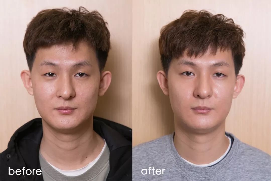 灏忚寕鑲岃瘖瀹ゅ埌搴曟湁澶氬己,灏忚寕鑲岃瘖瀹よˉ姘村悧