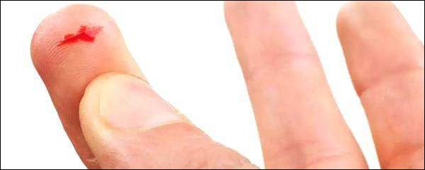 手指被纸划破为什么比刀还痛,手指被割伤了为什么会肿